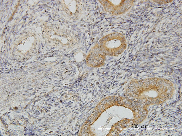 FLJ20643 Antibody in Immunohistochemistry (Paraffin) (IHC (P))