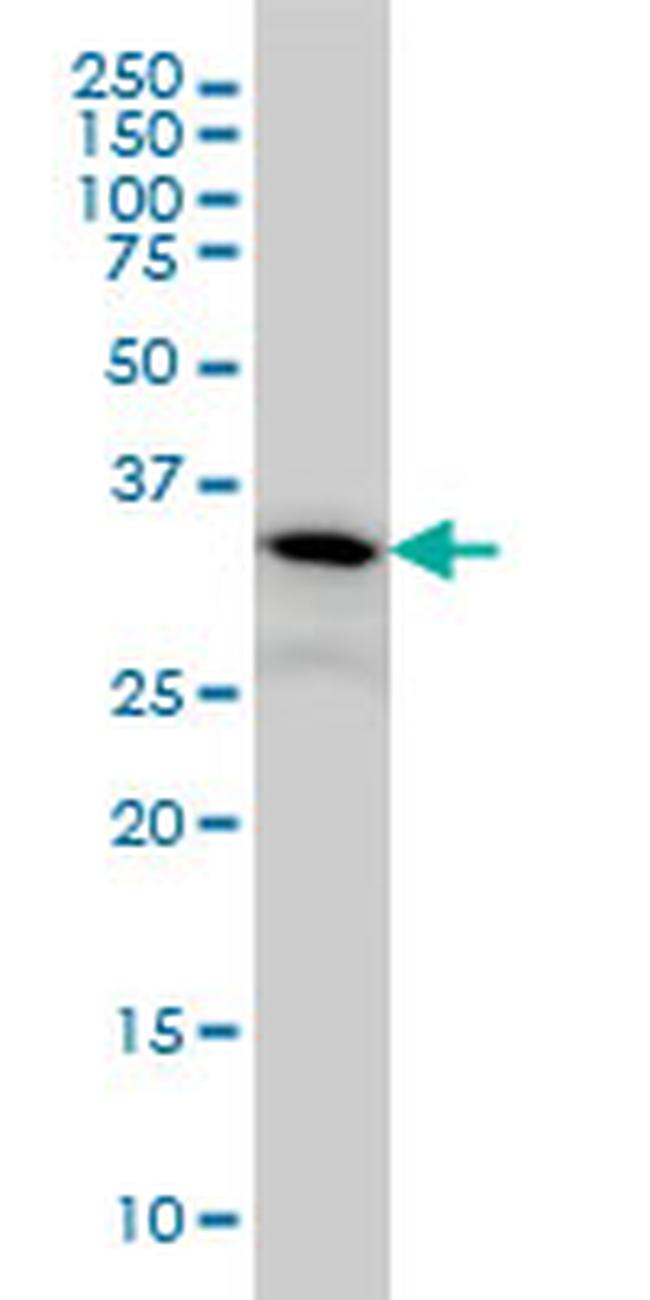 FLJ20643 Antibody in Western Blot (WB)