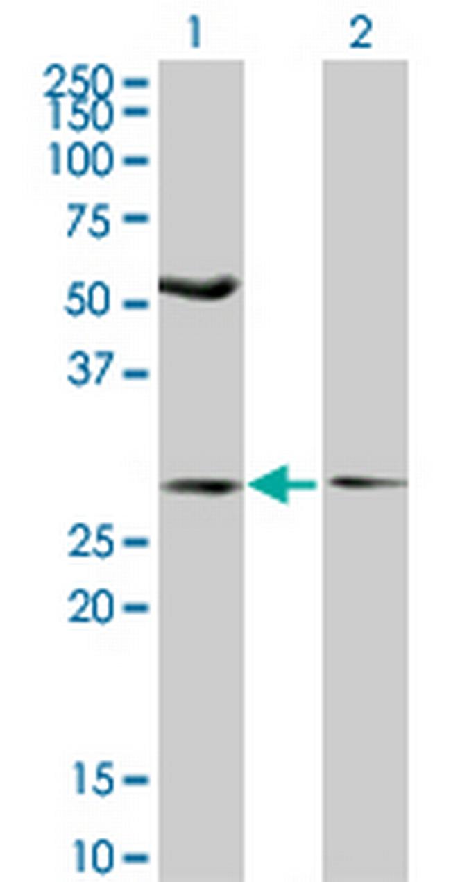 IFT57 Antibody in Western Blot (WB)