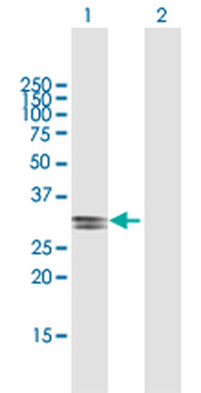 ECHDC2 Antibody in Western Blot (WB)