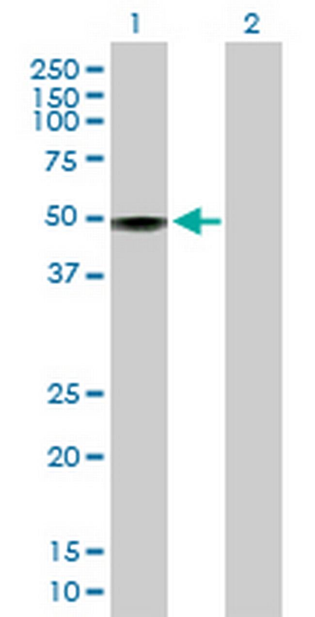 RP13-383K5.1 Antibody in Western Blot (WB)