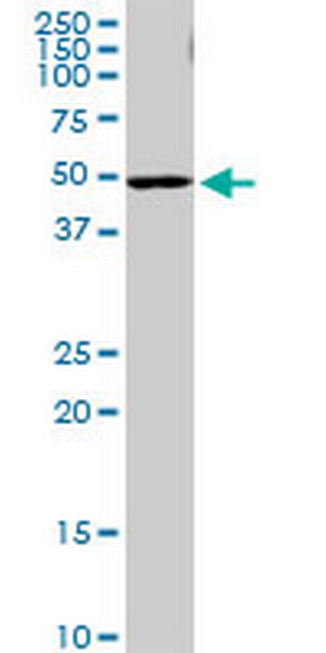 PI4KII Antibody in Western Blot (WB)