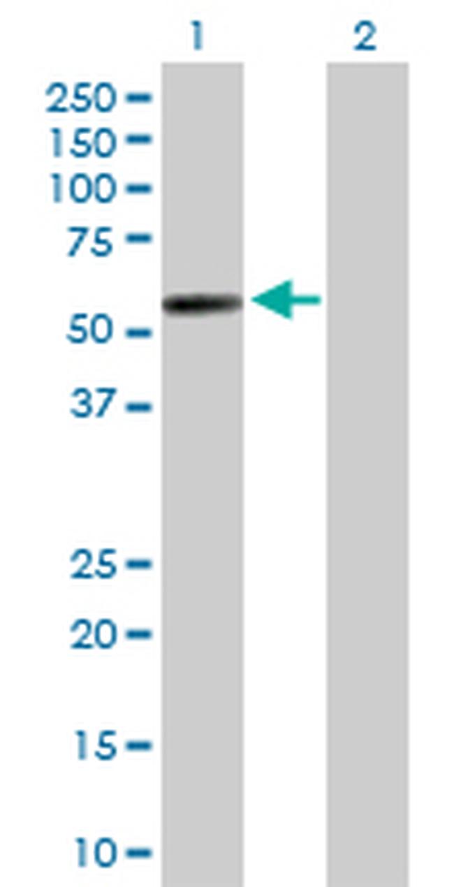 PI4K2A Antibody in Western Blot (WB)