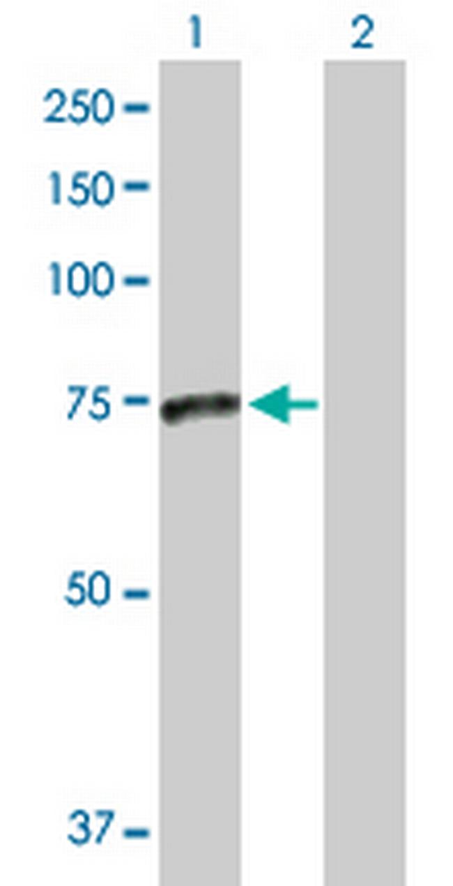 SMPD3 Antibody in Western Blot (WB)