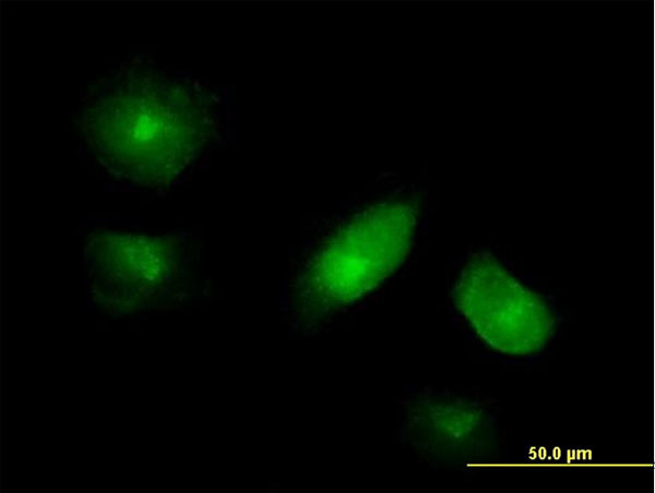 VAC14 Antibody in Immunocytochemistry (ICC/IF)