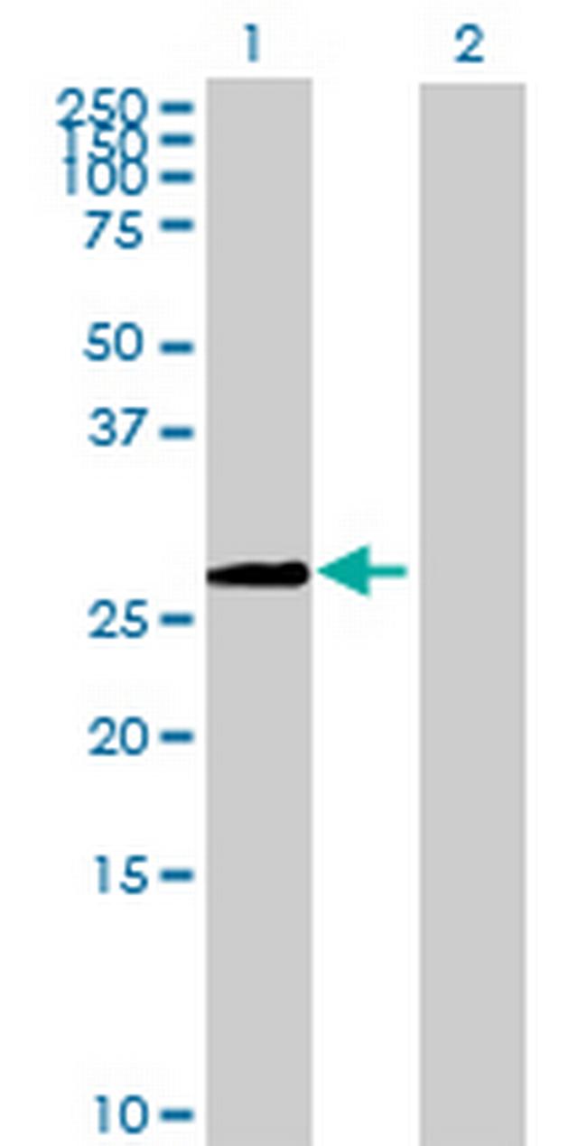 MDS032 Antibody in Western Blot (WB)