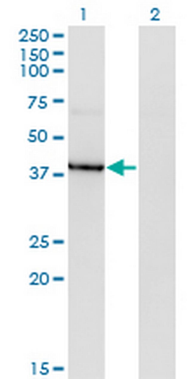 HDAC8 Antibody in Western Blot (WB)