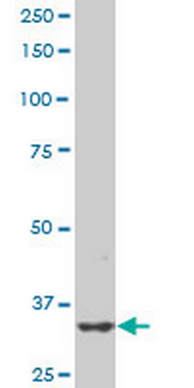 PBK Antibody in Western Blot (WB)