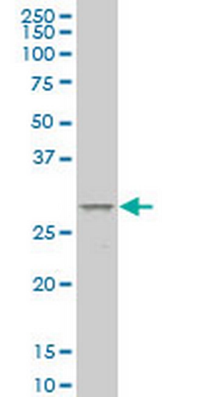 MESP1 Antibody in Western Blot (WB)