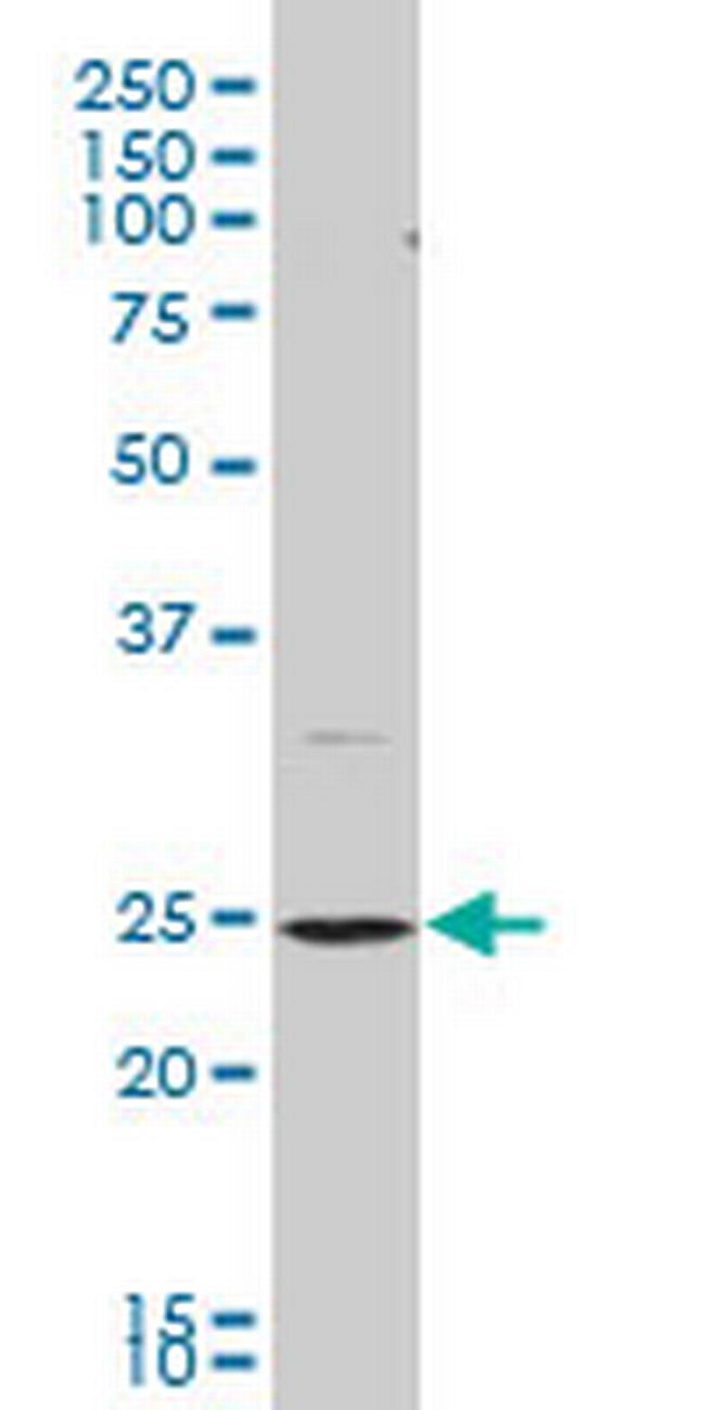 BCAP29 Antibody in Western Blot (WB)