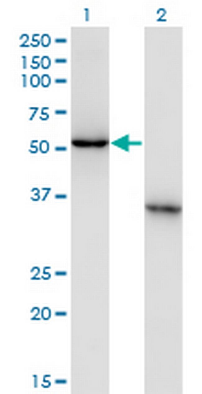 NXF3 Antibody in Western Blot (WB)