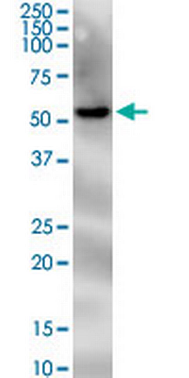 PNPLA2 Antibody in Western Blot (WB)