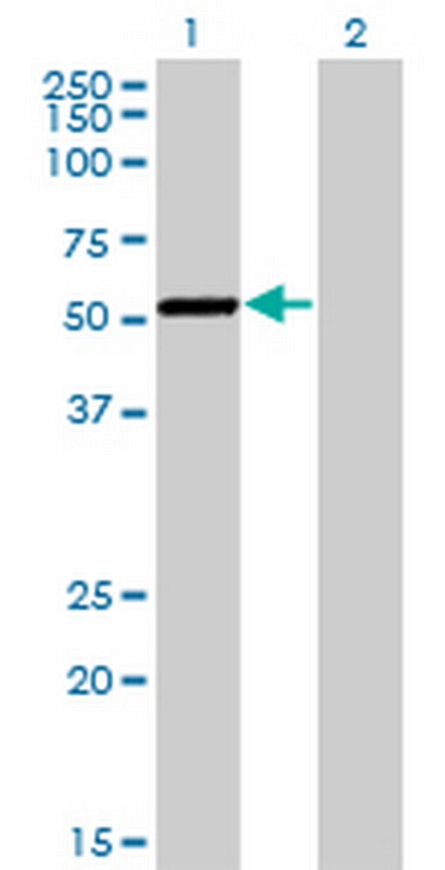 CAMK1G Monoclonal Antibody (3E2) (H00057172-M01)