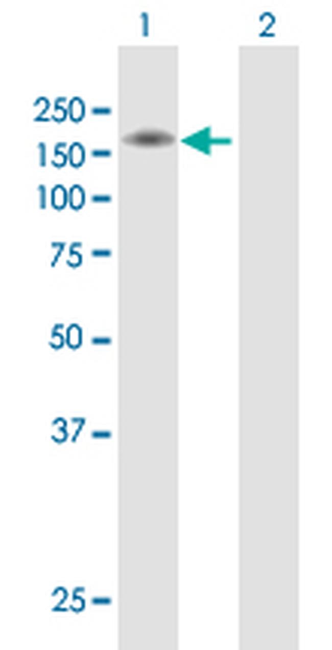 SEMA6A Antibody in Western Blot (WB)