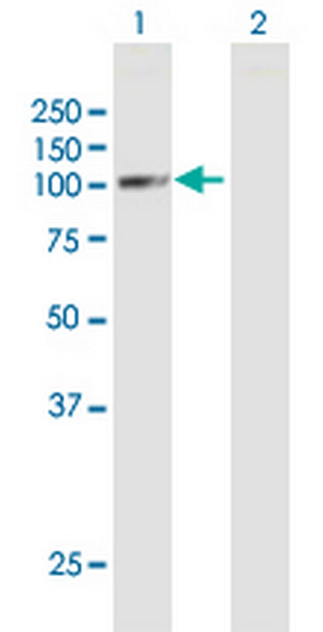 GPAM Antibody in Western Blot (WB)