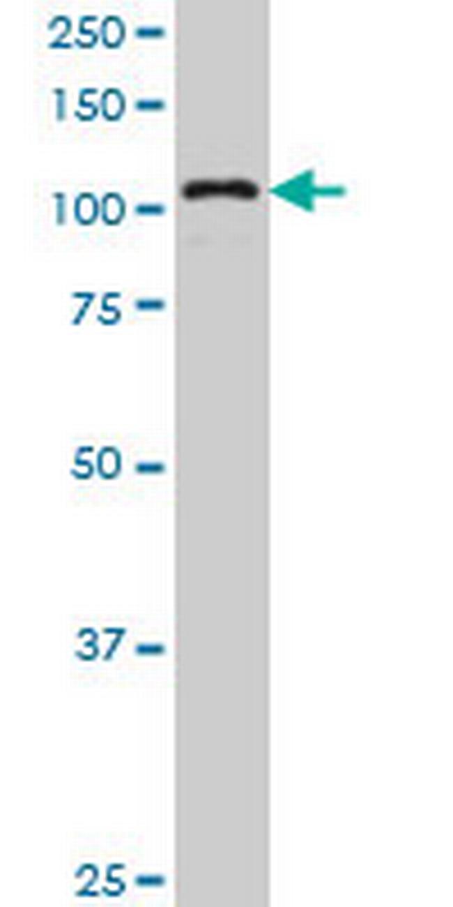 KIAA1967 Antibody in Western Blot (WB)