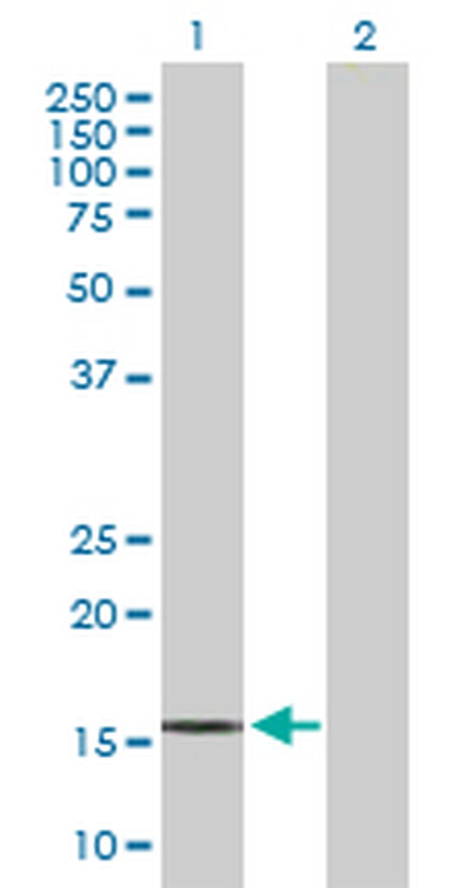 IL21 Antibody in Western Blot (WB)