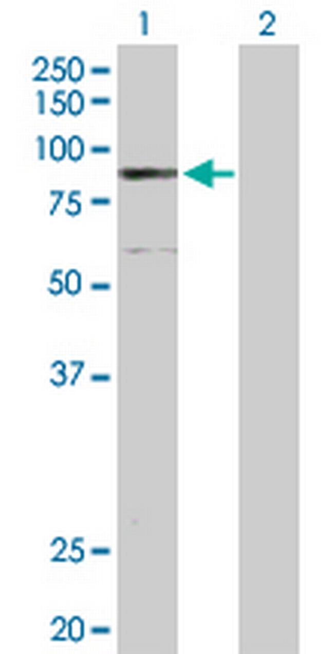 ELAC2 Antibody in Western Blot (WB)
