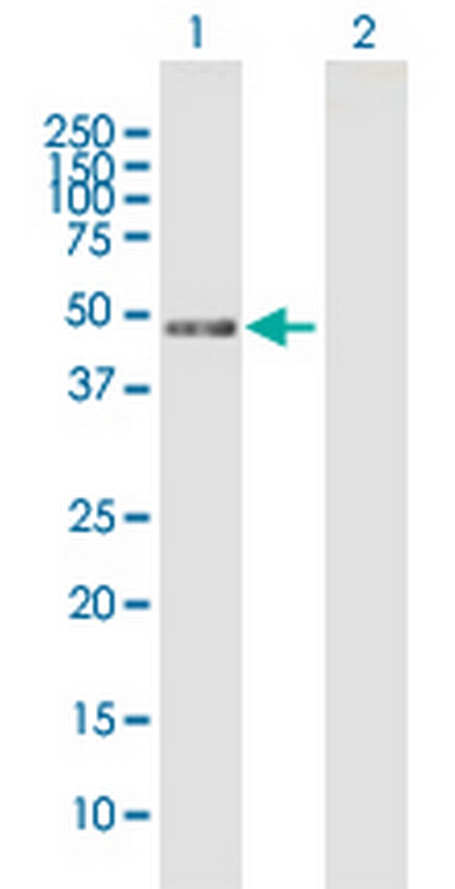 MIIP Antibody in Western Blot (WB)