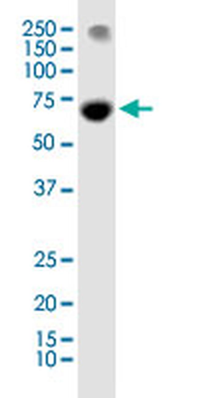 PRDM14 Antibody in Western Blot (WB)