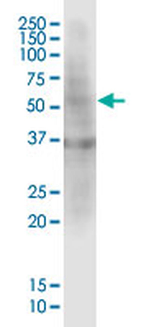 PRDM14 Antibody in Western Blot (WB)