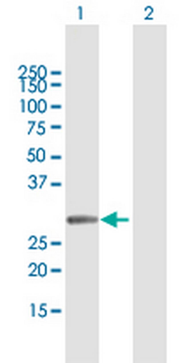 MMS19 Antibody in Western Blot (WB)