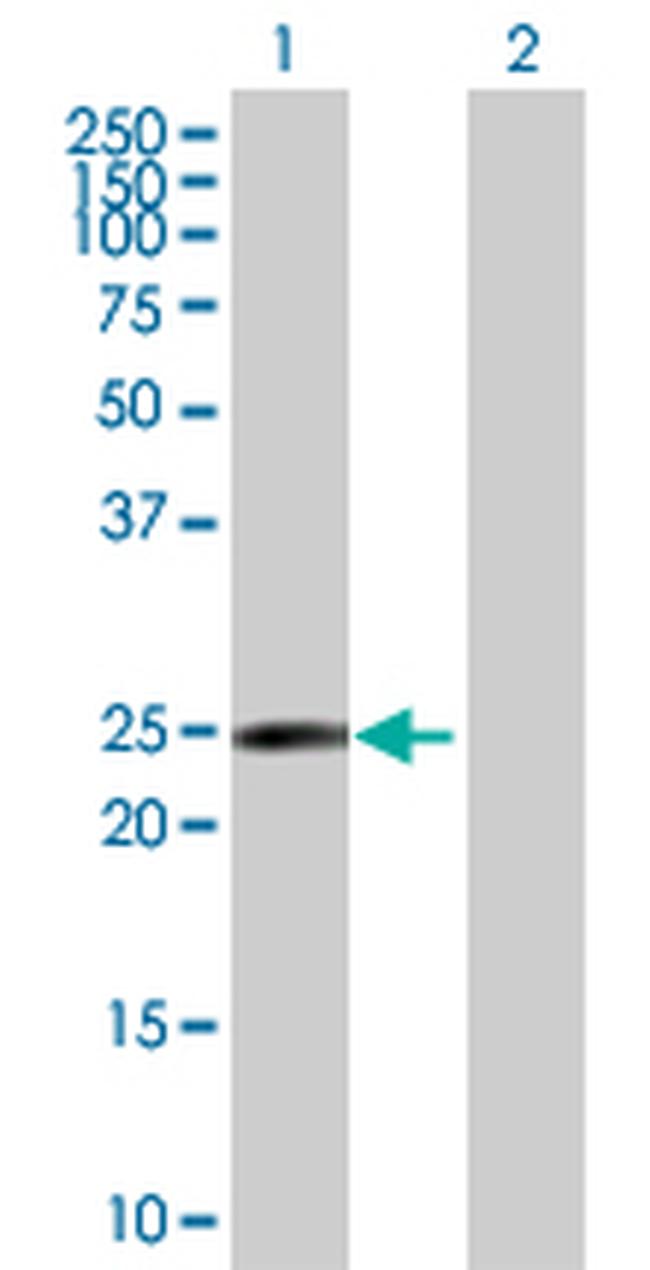 RAB17 Antibody in Western Blot (WB)