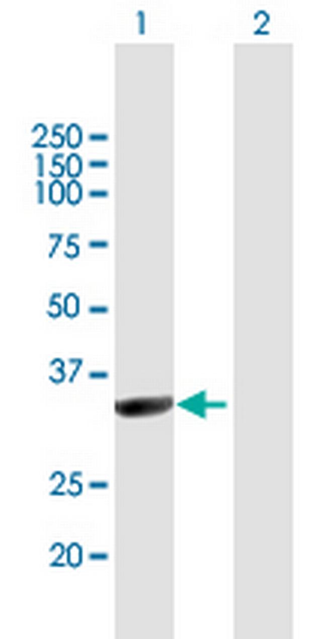 NMNAT1 Antibody in Western Blot (WB)