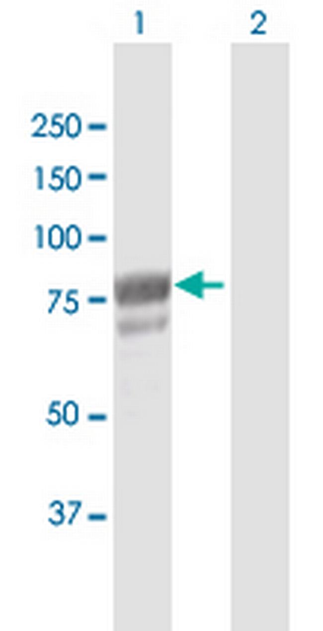 DHX58 Antibody in Western Blot (WB)