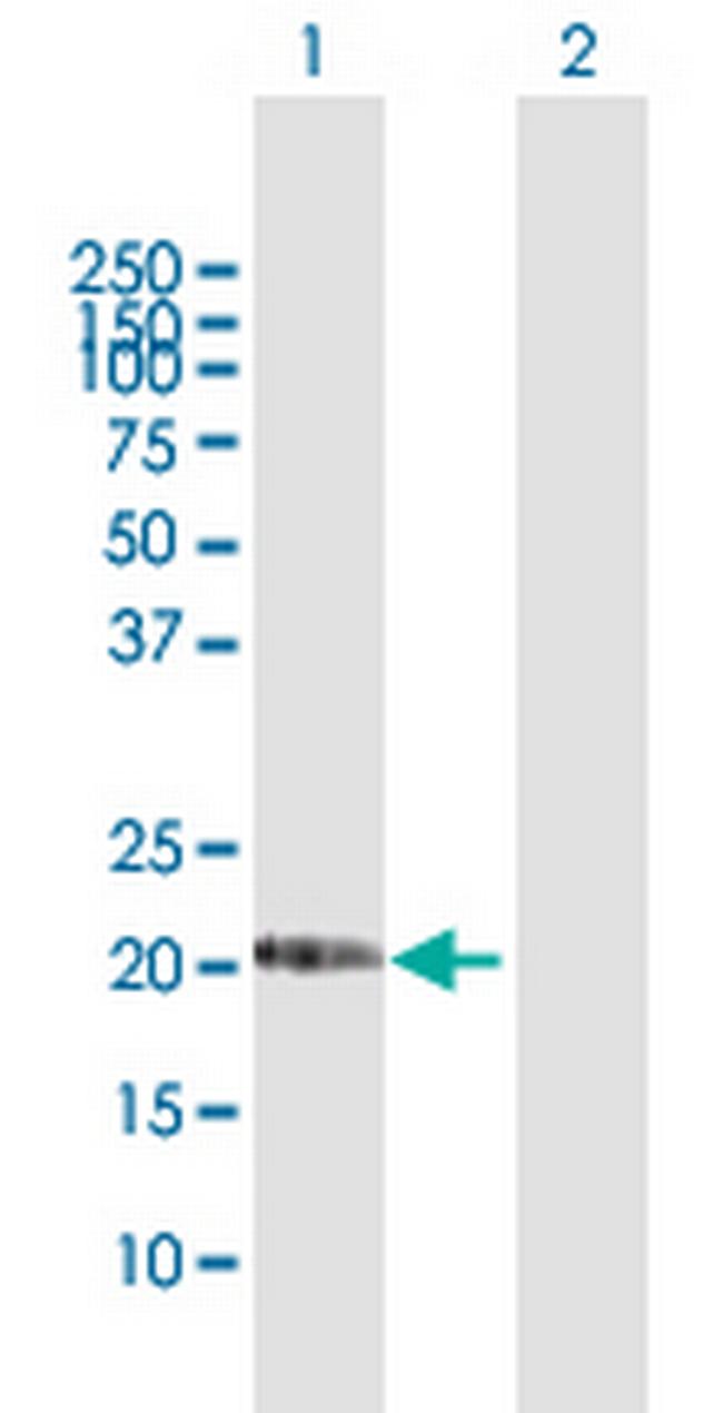 DHRS11 Antibody in Western Blot (WB)