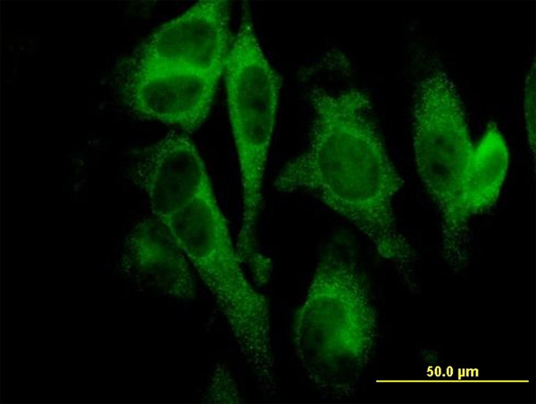 GSDMD Antibody in Immunocytochemistry (ICC/IF)