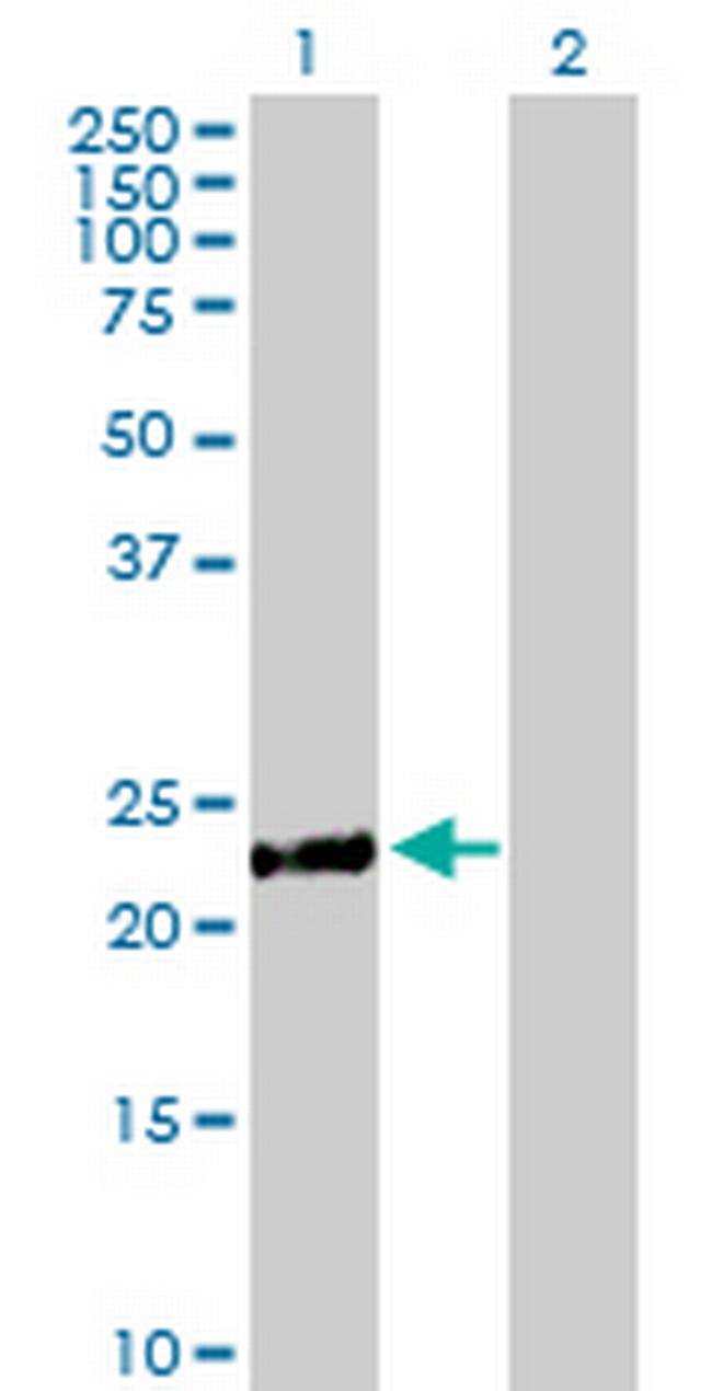 DCAKD Antibody in Western Blot (WB)