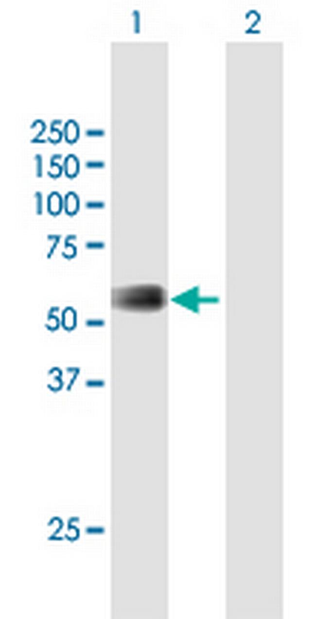 RMI1 Antibody in Western Blot (WB)