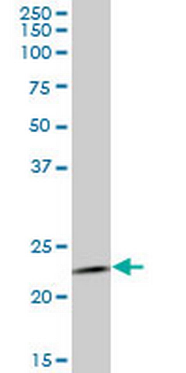 RAB1B Antibody in Western Blot (WB)