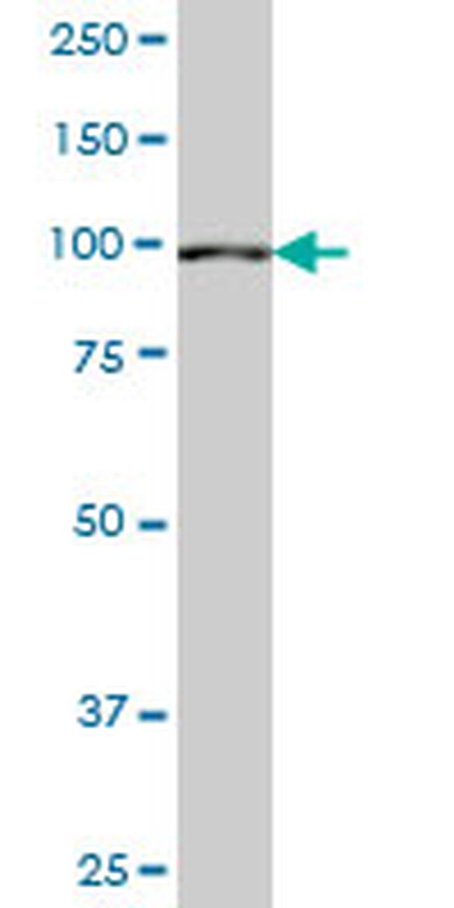 SETDB2 Antibody in Western Blot (WB)