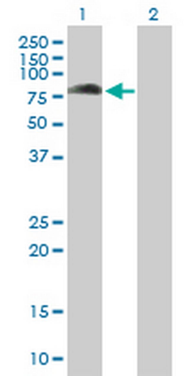 KBTBD7 Antibody in Western Blot (WB)