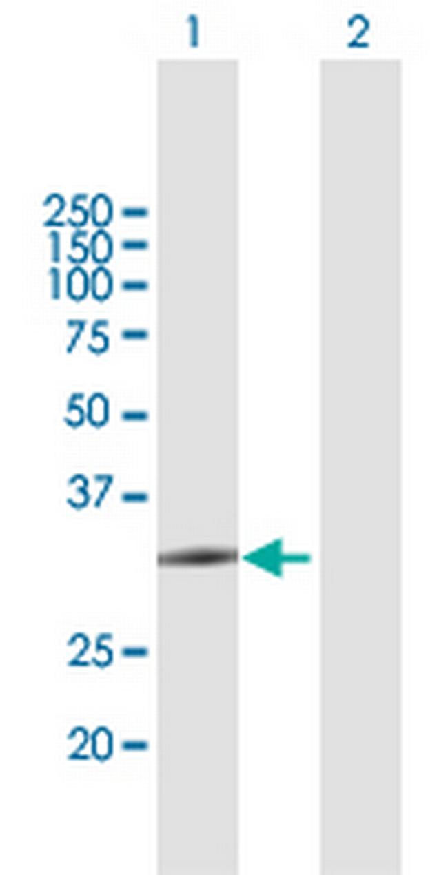 ZCCHC9 Antibody in Western Blot (WB)