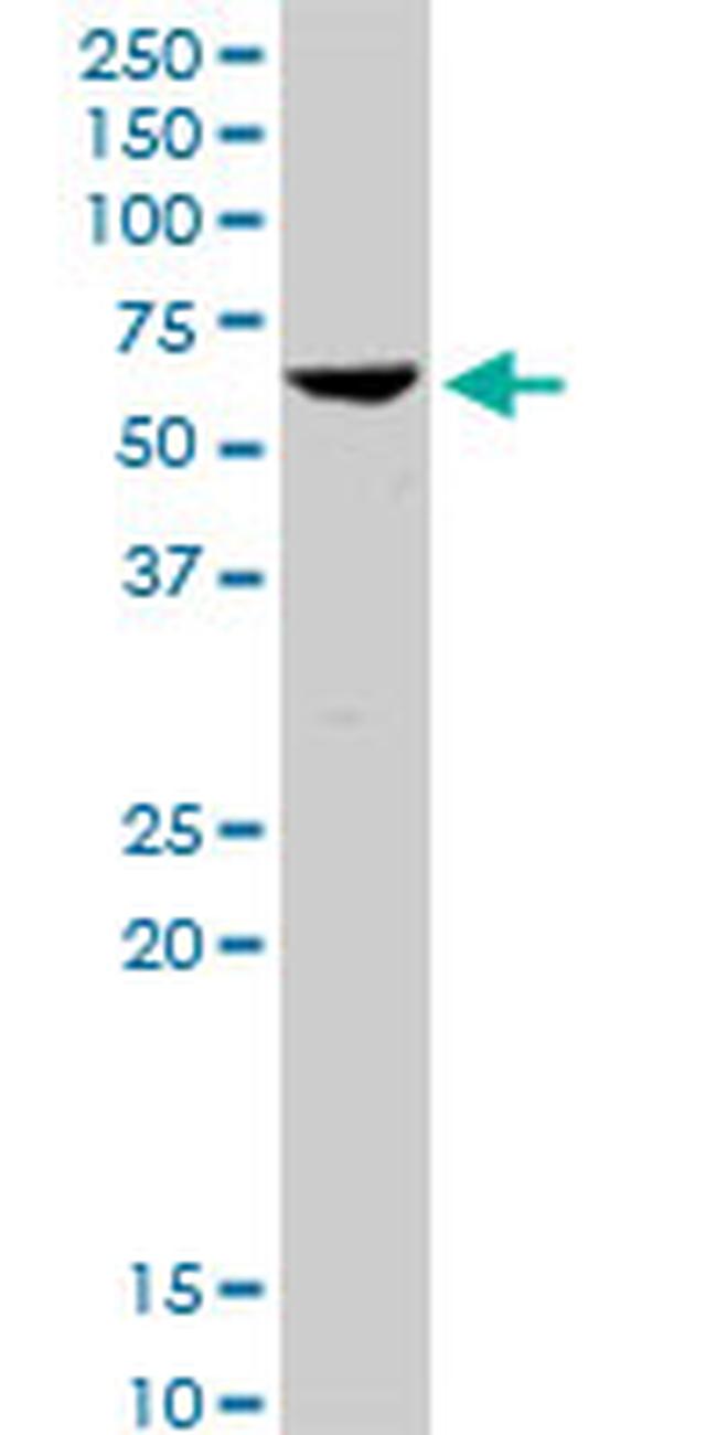 SYVN1 Antibody in Western Blot (WB)