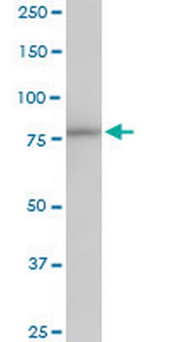 PNPT1 Antibody in Western Blot (WB)