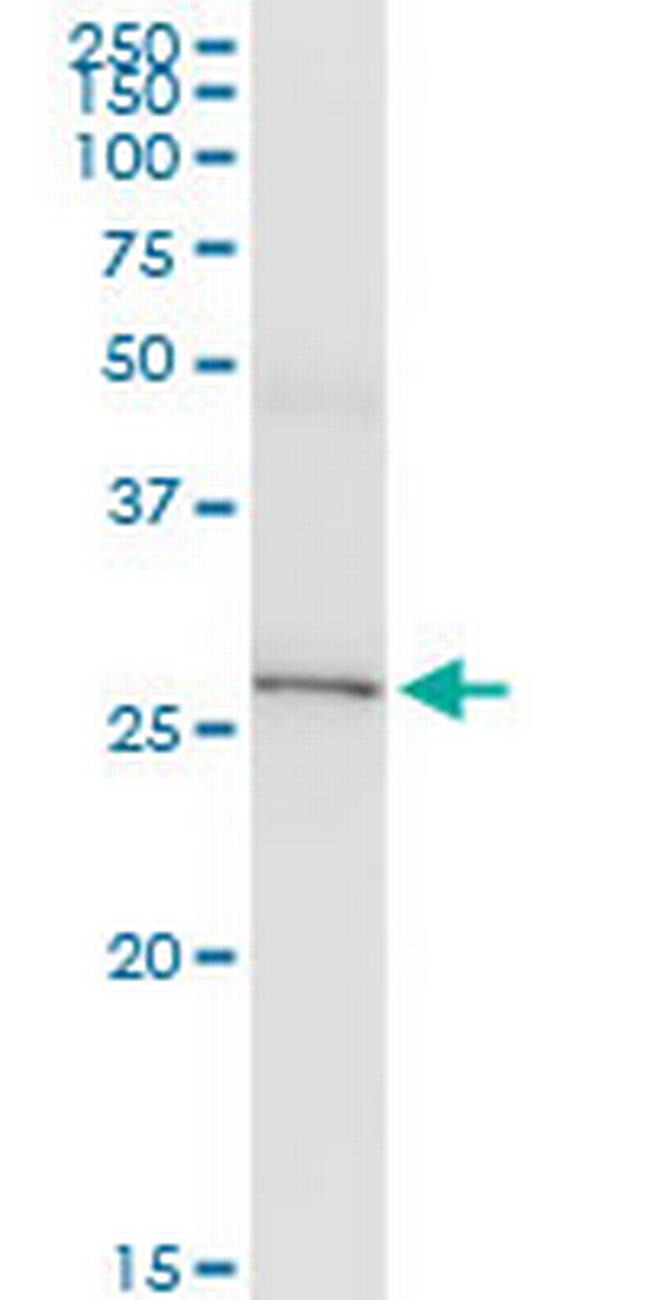 IL33 Antibody in Western Blot (WB)