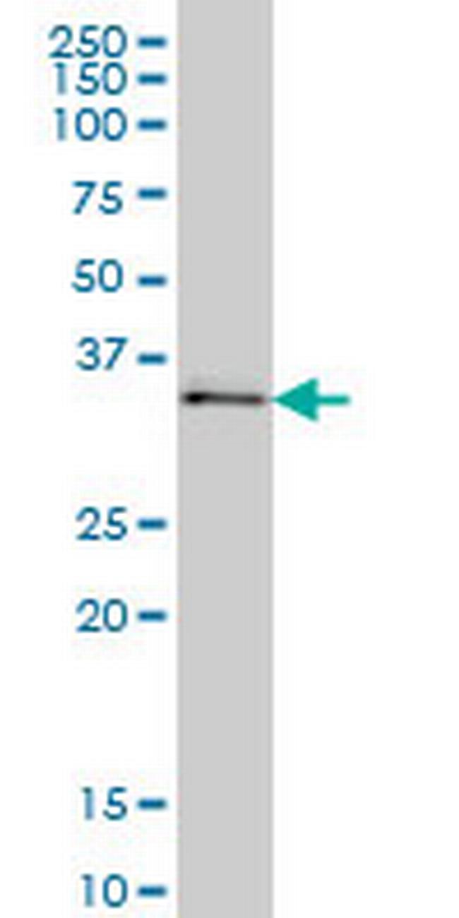 UBE2Q2 Antibody in Western Blot (WB)