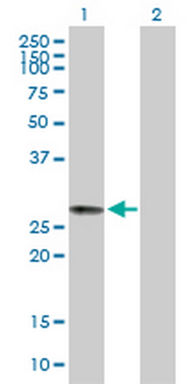 C6orf117 Antibody in Western Blot (WB)