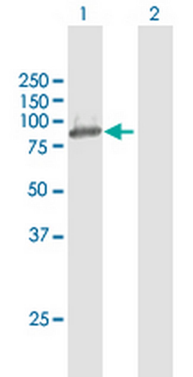 OSBPL10 Antibody in Western Blot (WB)