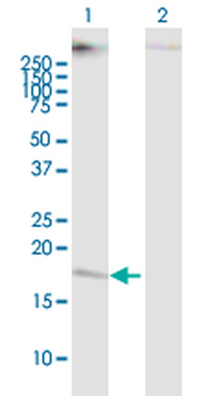 CMTM5 Antibody in Western Blot (WB)