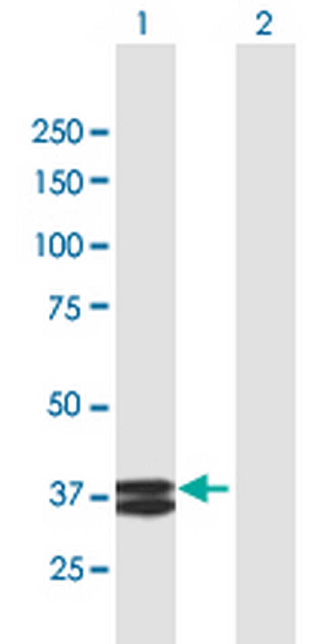 APOA5 Antibody in Western Blot (WB)