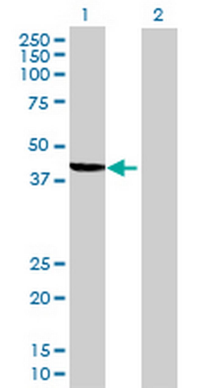 C10orf4 Antibody in Western Blot (WB)