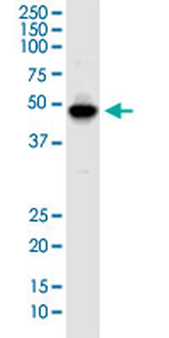 IKIP Antibody in Western Blot (WB)