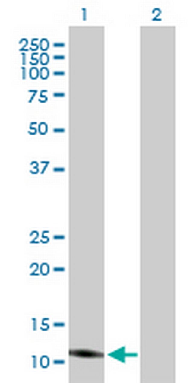 ISCA2 Antibody in Western Blot (WB)