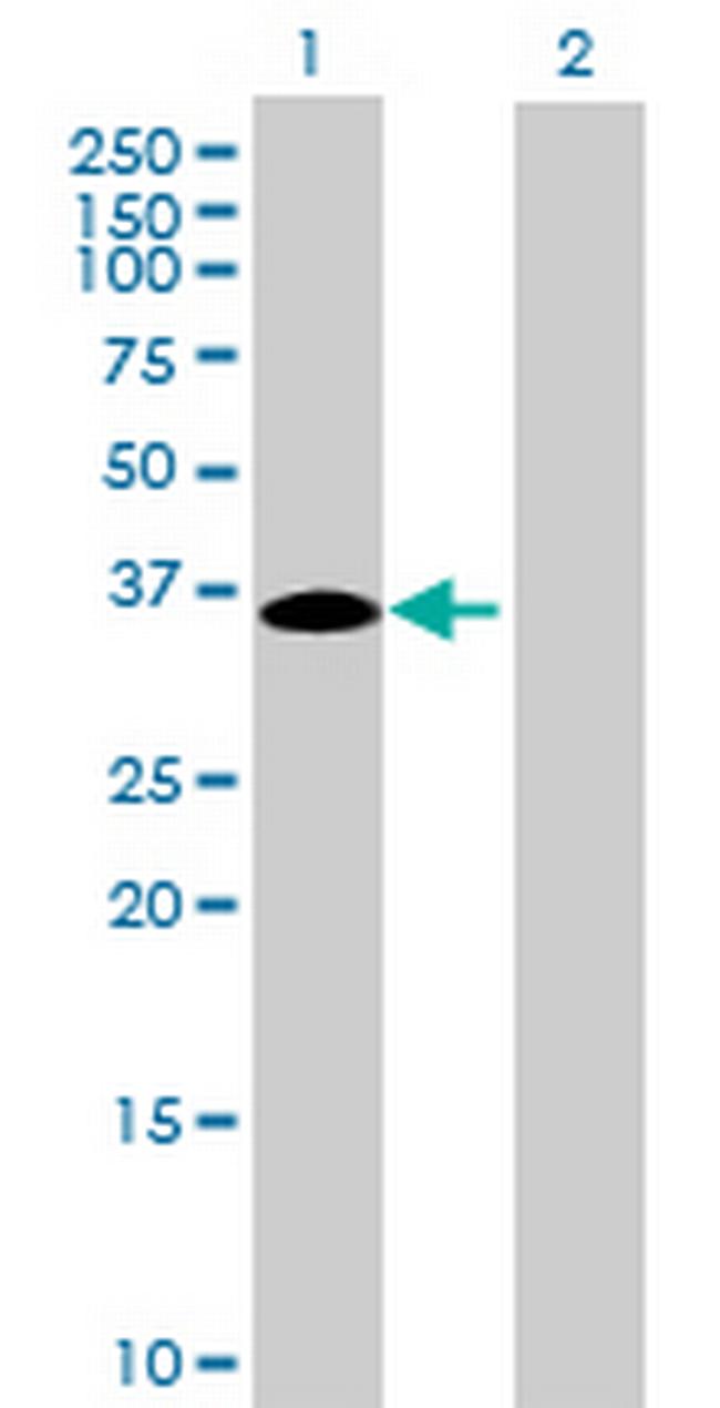 MGC33367 Antibody in Western Blot (WB)