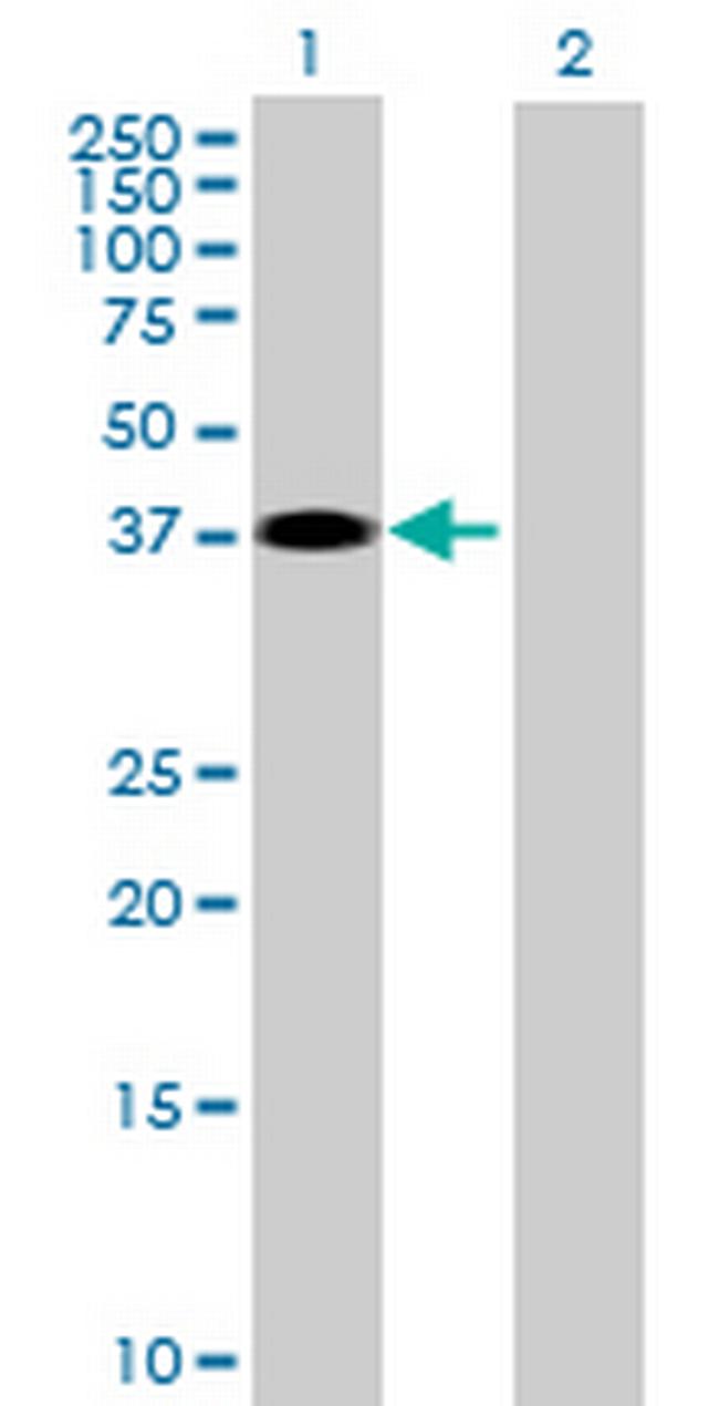 ZPBP2 Antibody in Western Blot (WB)